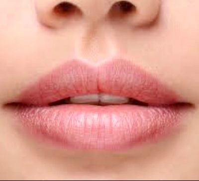 Lip Augmentation with Dermal Fillers in Stockport and Cheshire. Mwah Aesthetics 