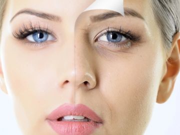 Chemical skin peels in Stockport and Goostrey by aesthetic nurse Debbie