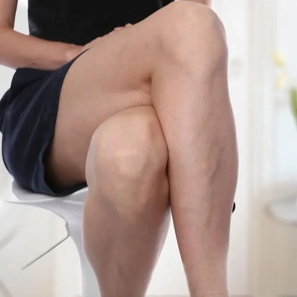 Lady leg with vein