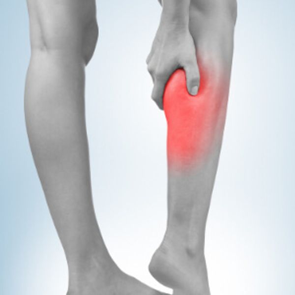 Leg cramp claudication arterial disease