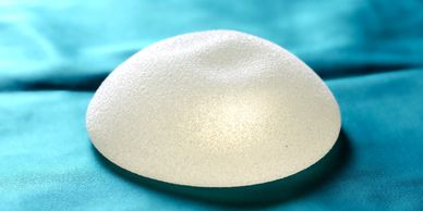 allergen breast implant lawsuit
