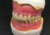 Complete acrylic dentures
