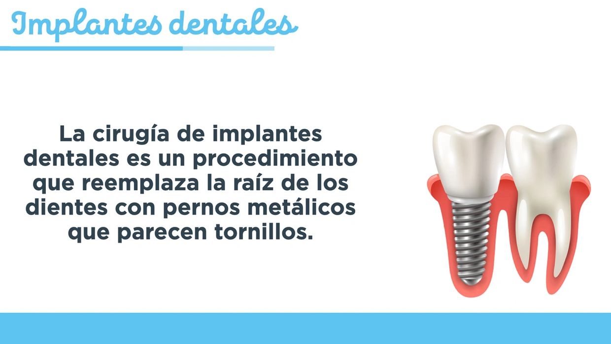 implantes dentales en ponce odontologia en barranquilla