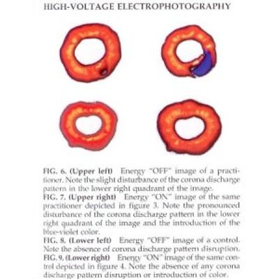 Healing Energy releasing from Dr. Huo's Finger Tip captured on Kirlian photos. Acupuncture,