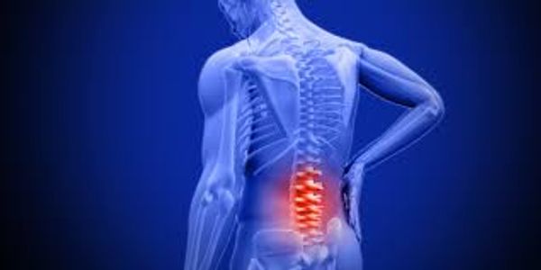 Ankylosing spondylitis treatment