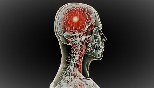 Brain cancer treatment