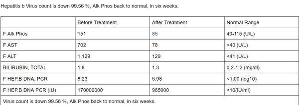 Hepatitis B