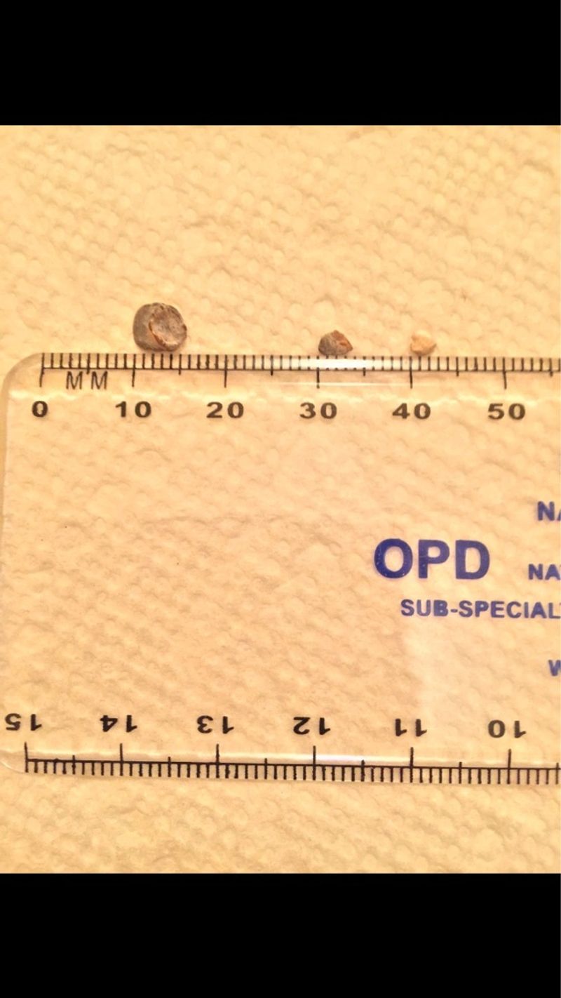 Treatment image