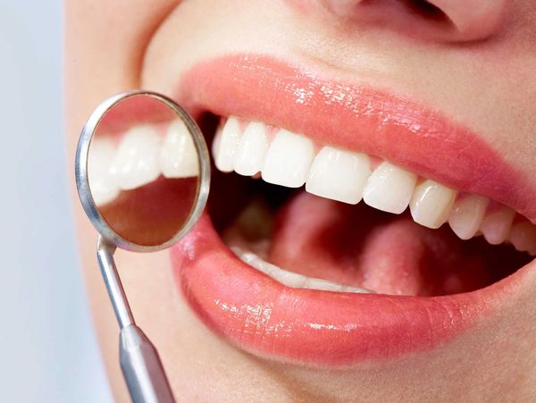 Close-up of a smiling mouth with dental mirror showing white teeth.