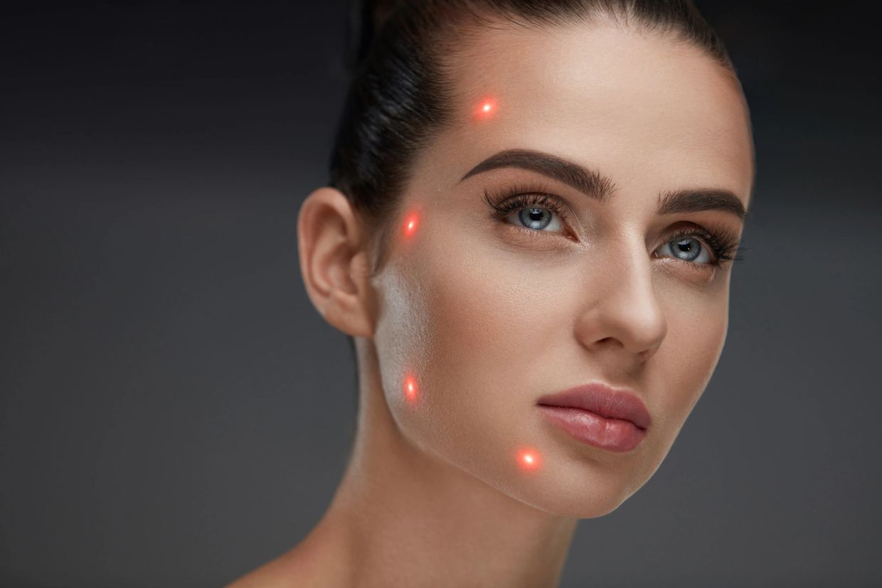 paciente que se va a someter a una limpieza facial laser