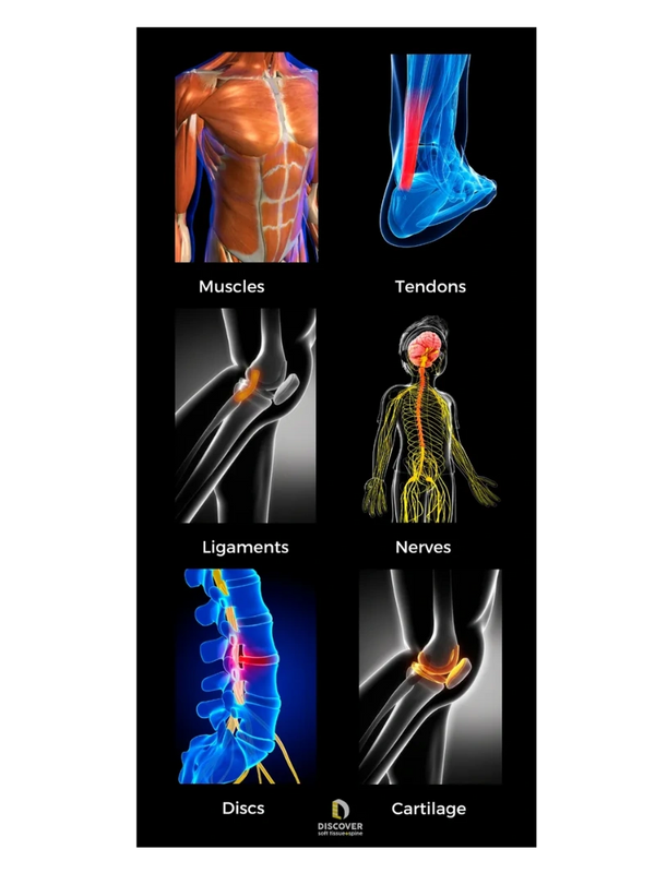 Soft tissues consist of muscle, tendon, ligament, nerve, cartilage and disc