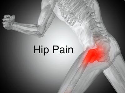 Hip Pain Treatment