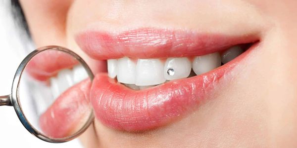 Close-up of a smile with a dental jewel on a tooth and a dental mirror reflecting the lips.