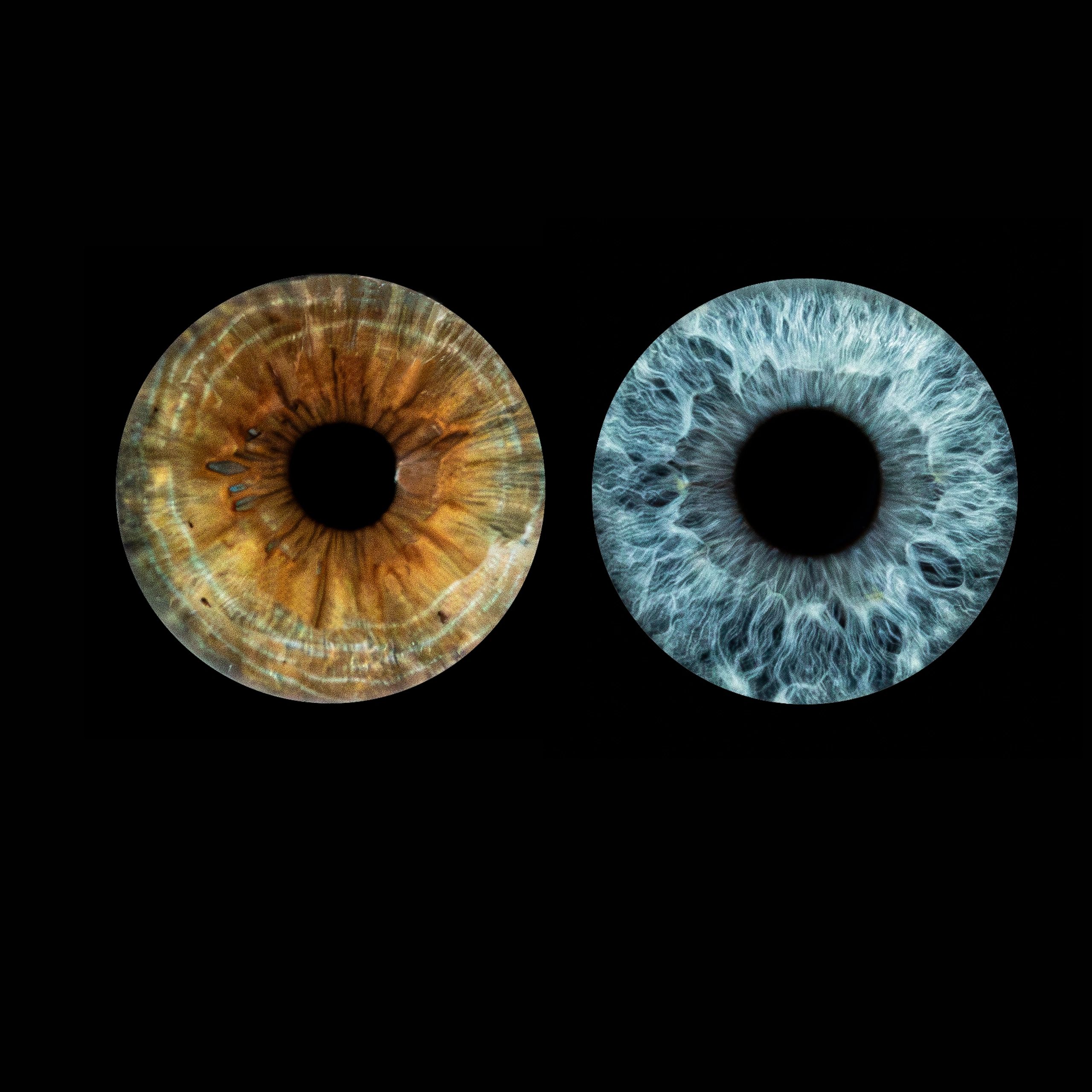 Close-up of two different colored human irises against a black background.