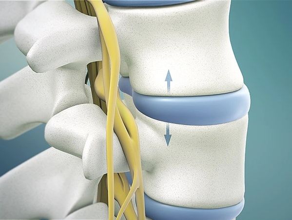 Spinal decompression