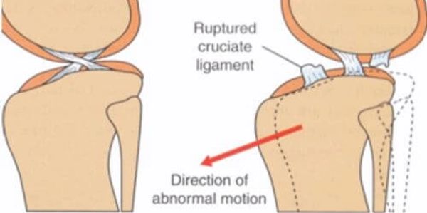 anatomie, ccl, dog torn acl, rehab ccl, cranial cruciate ligament acupuncture laser therapy pet help