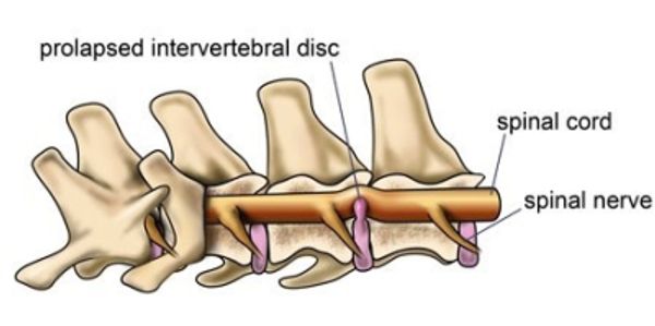 IVDD, intertibral disc disease, spinal, dog paralysed, dog, underwater treadmill, anatomie