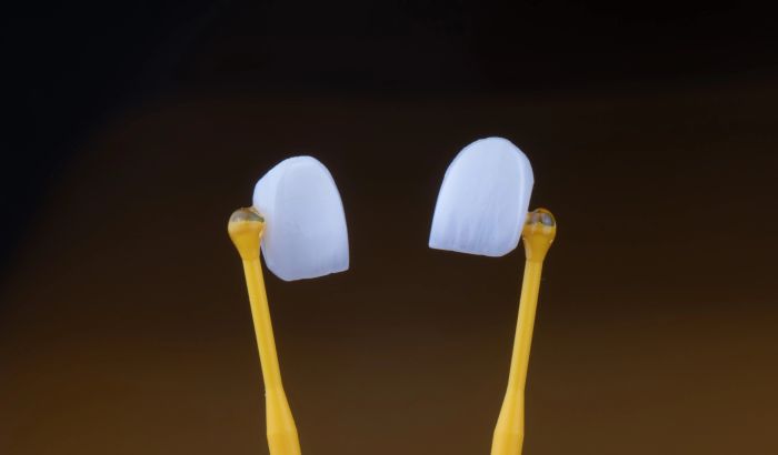 Participant preparing a tooth for veneers under instructor guidance