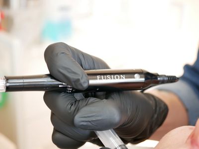 Microneedling - Das beste gegen Falten
