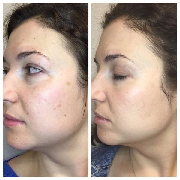 Photofacial Results