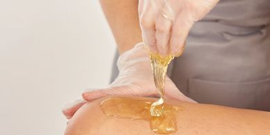 Sugaring of a persons leg