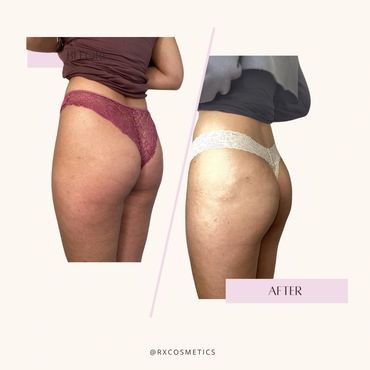 Real client transformations

Safe cosmetic treatments Toronto

Subtle natural results before and aft