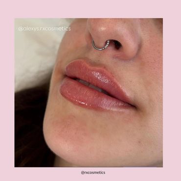 RxCosmetics before and after

RxCosmetics results

Medical aesthetics before and afte