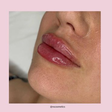 Skin clinic near me Toronto

Nurse injector Toronto