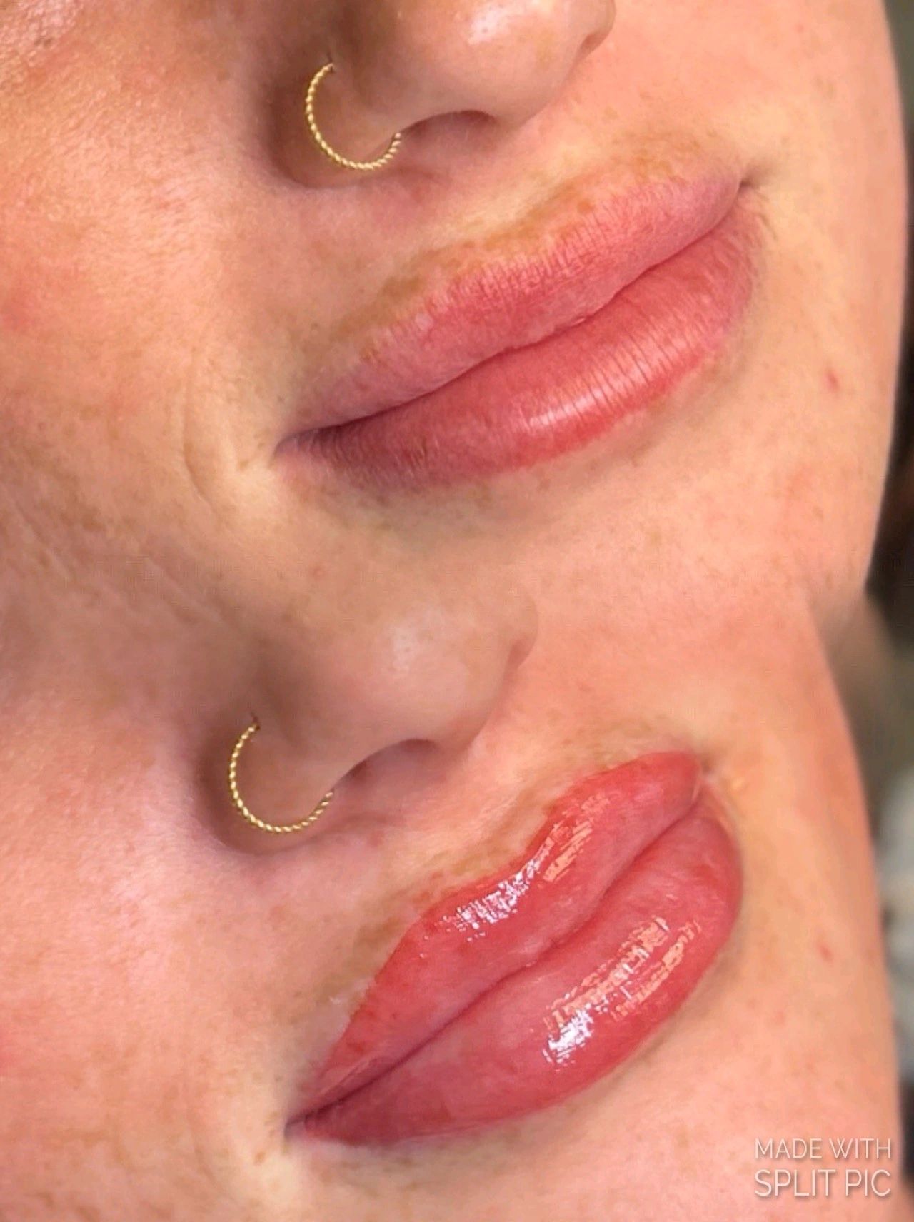 Close-up of lips before and after glossy lip enhancement with a nose ring visible.