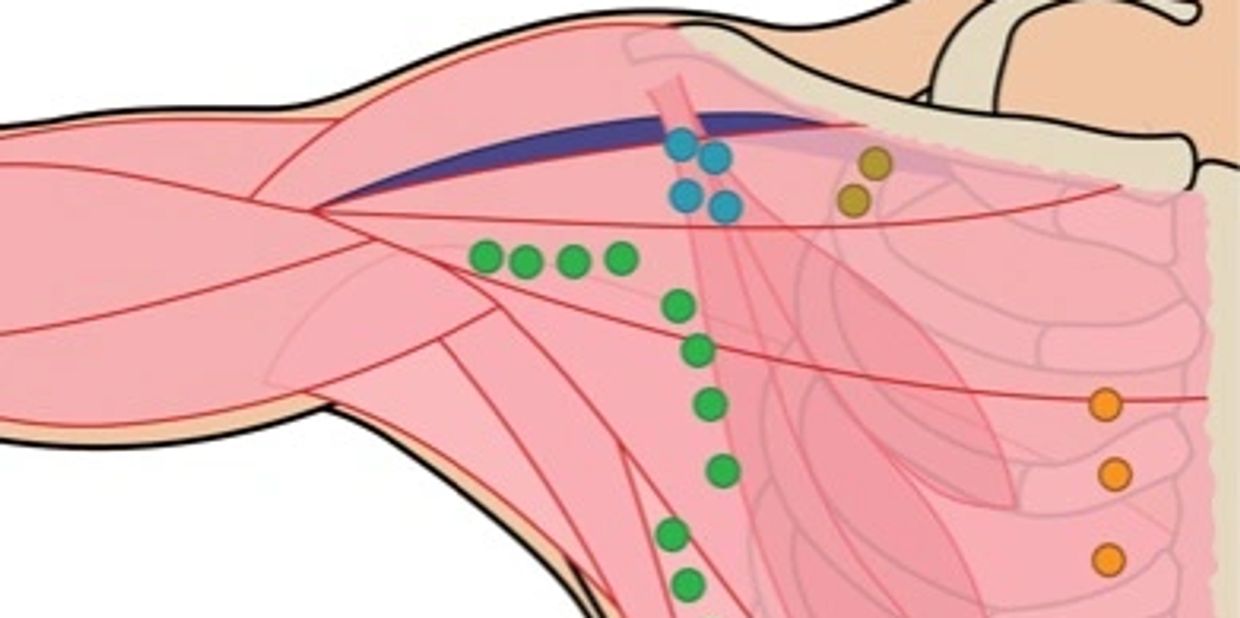 LYMPHEDEMA WITH ACUPUNTURE AND LOW LEVEL LASER