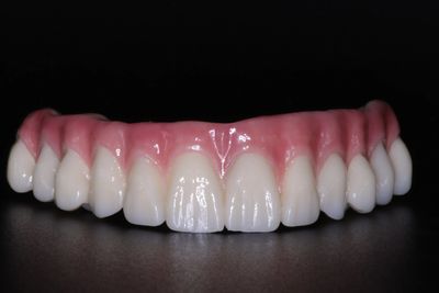 Esthetic Implants