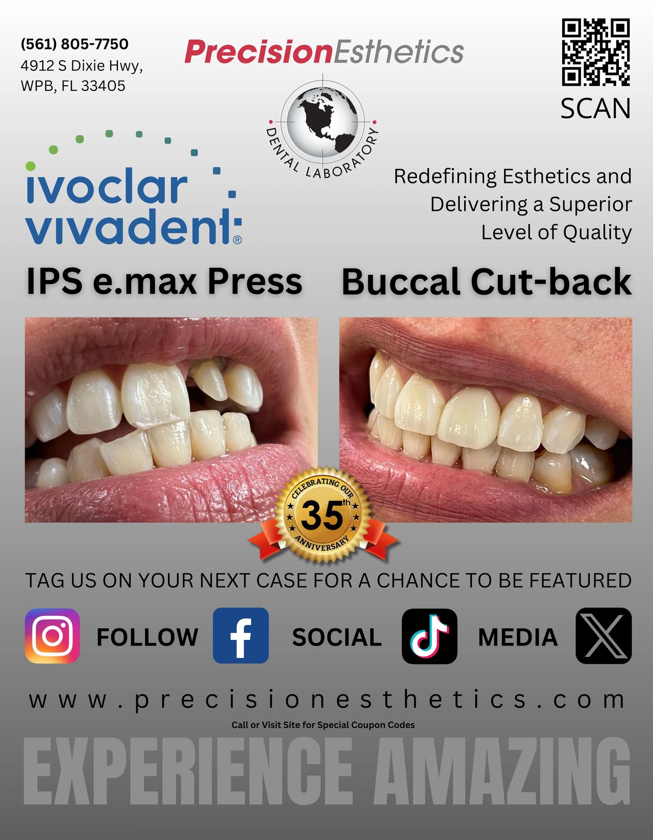 IPS e.max Press, The #1 Solution for Veneers, Crowns, and Bridges