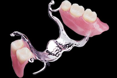 CrCo Partial Dentures