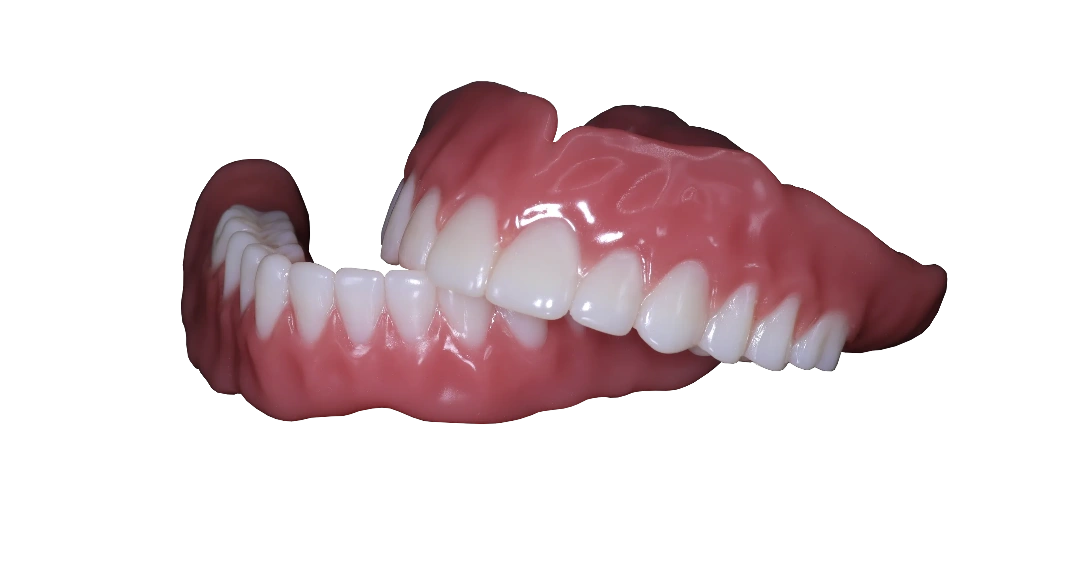 Discover The Digital Denture Express