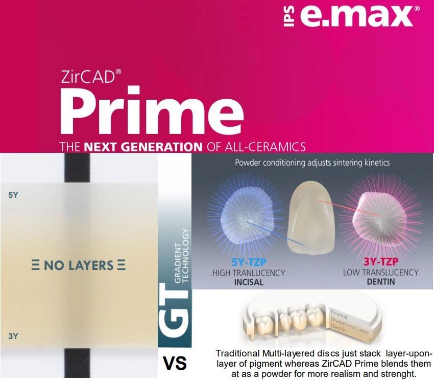 IPS e.max ZirCAD Prime is the next generation of all ceramics