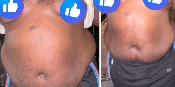 Our Lipo Shots works on GUYS too! Rapid results, Targeted Fat Reduction, Non-Surgical, & Convenient.