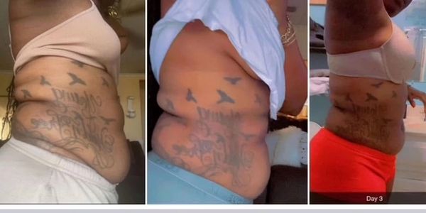 3 day results with Powers Lipo Shots in Lincoln NE