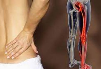 Osteopathy For Sciatica at Chelmsford Osteopathy Clinic
