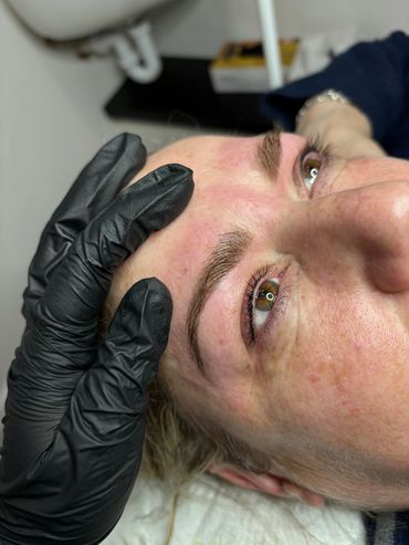 Eyelash Enhancement