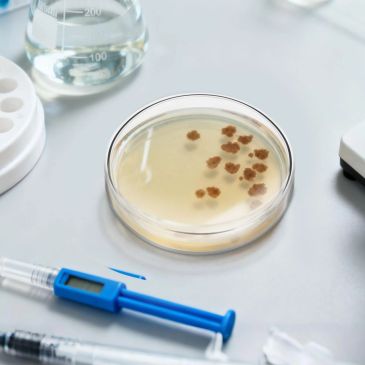 Petri dish with bacterial colonies on a lab bench.