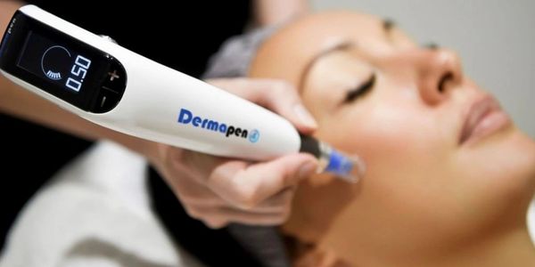 A woman receiving a Dermapen microneedling treatment on her face.