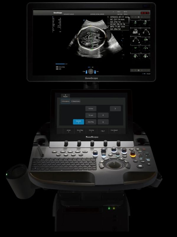 SonoScape P60 Wis+ Platform, Intelligence based ultrasound platform. Echo OB GEN/VASC US Machine