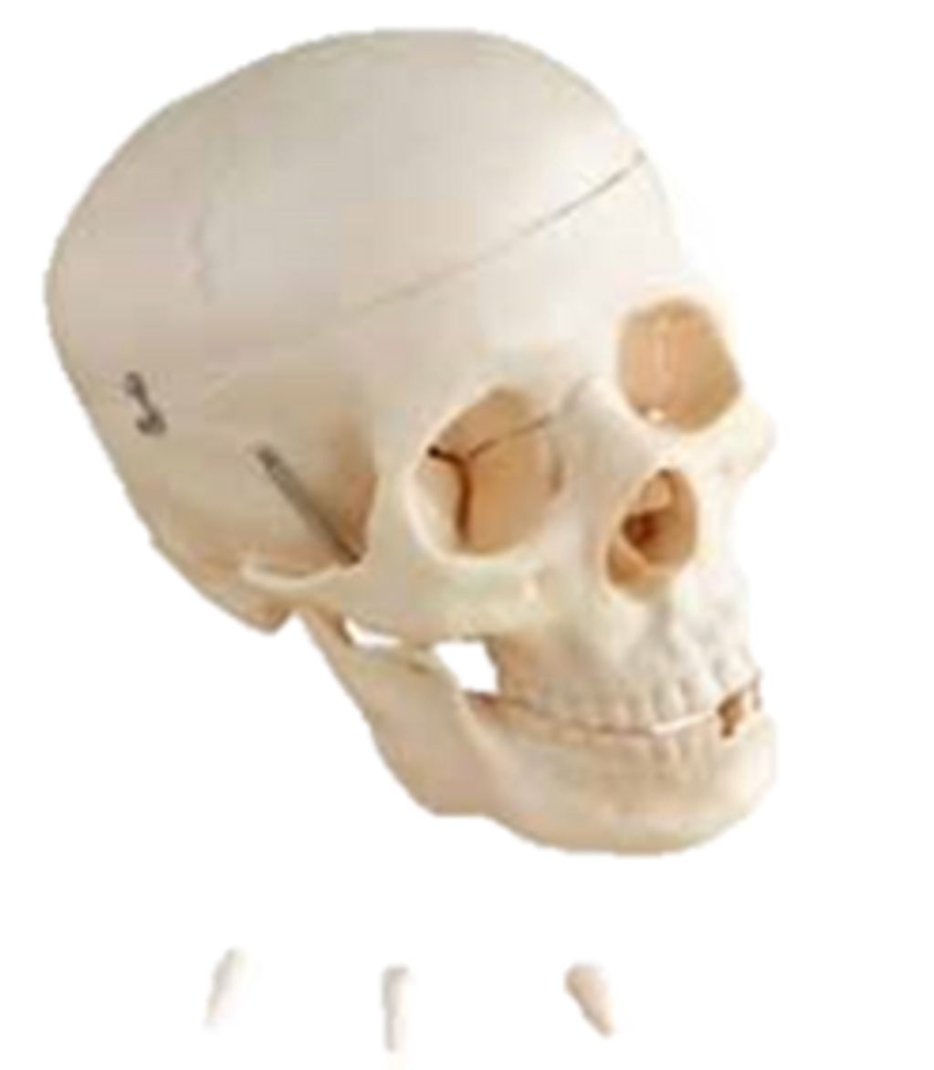Modelo de cráneo humano con dientes extraíbles.