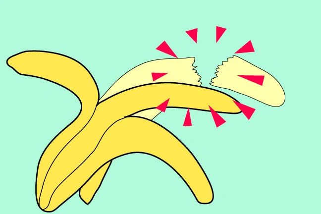 كسر القضيب أسباب كسر القضيب و علاج كسر القضيب كسر القضيب أسباب كسر القضيب و علاج كسر القضيب