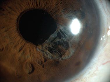 افضل دكتور لعلاج أمراض البروستات في الاردن افضل دكتور لعلاج أمراض البروستات في الاردن