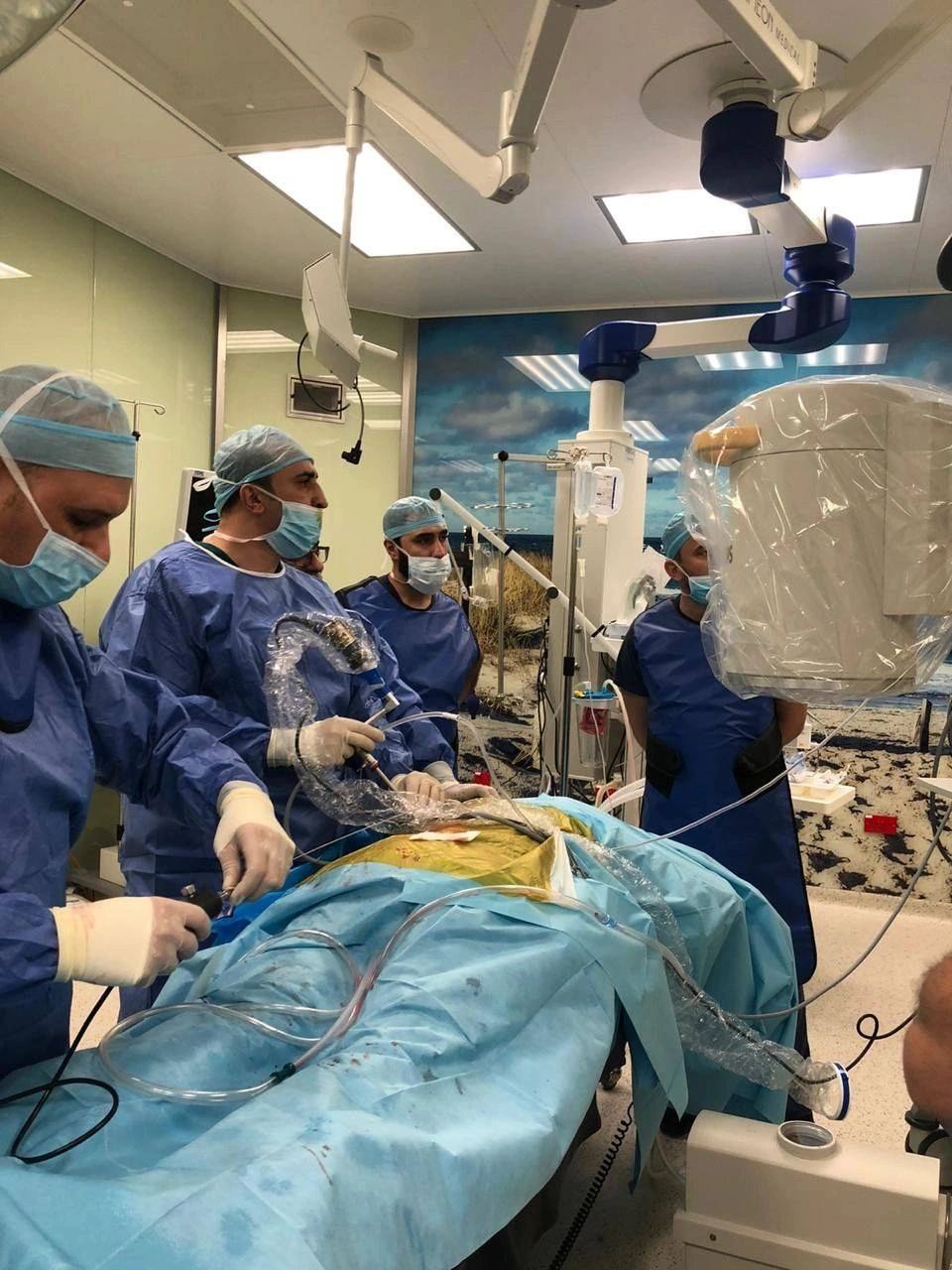 تفتيت حصى الكلى بالليزر