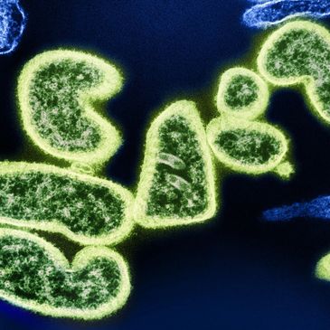 Microscopic image of virus particles glowing in green.