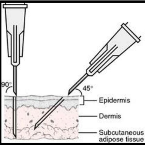 Diagram for how to inject Melanotan 2