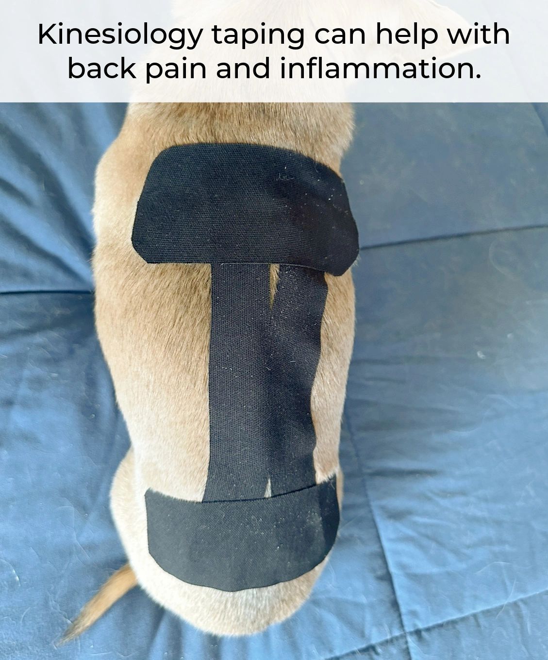 Kinesiology taping has been shown to decrease pain by blocking pain signals.