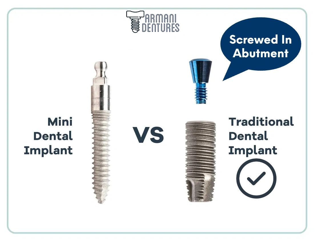 Dental Implants Chevy Chase Armani Dentures